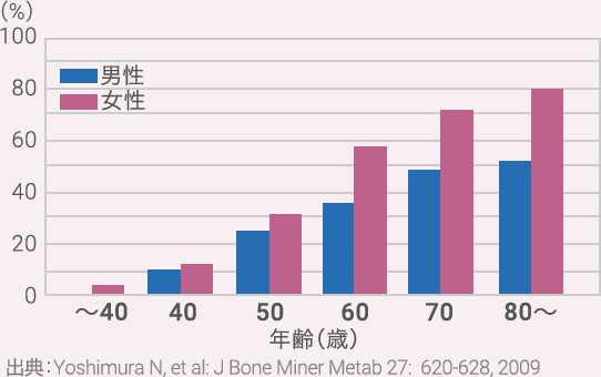 変形性膝関節症の1次性の危険因子例