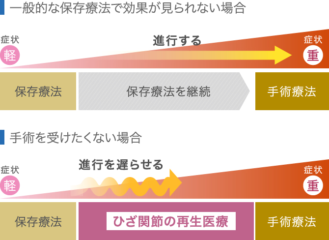 保存療法と再生医療の比較