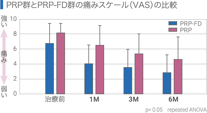 PRP-FD注射は変形性膝関節症の治療に向いています